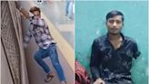 SHOCKER! Mumbai Boy Addicted To Train Stunts, Loses An Arm A Leg, Literally