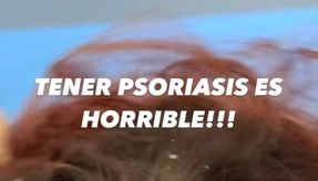 Hija de Daddy Yankee comparte sus problemas con la psoriasis al lavarse el pelo