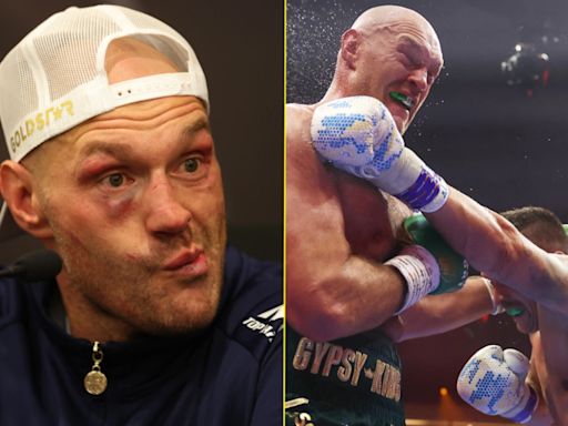 Tyson Fury removed from IBF heavyweight rankings but the reason makes sense