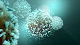 Immunotherapy After Kidney Cancer Surgery Improves Overall Survival