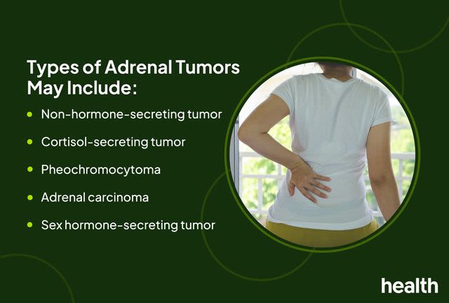 Signs and Symptoms of Adrenal Cancer
