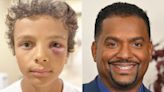 Alfonso Ribeiro Reveals New Details About Son AJ's Black Eye: 'It's Part of Baseball' (Exclusive)