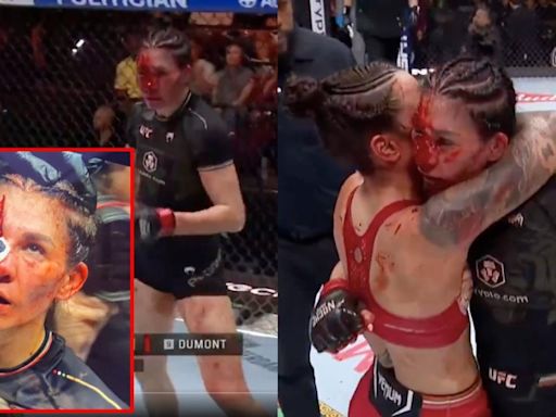 UFC 306: Irene Aldana y la TERRORÍFICA cortada en toda la cara que pone en riesgo su salud (VIDEO)