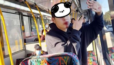新西蘭中國留學生巴士遇襲 神秘女辱罵兼擸鐵棍打甩5隻牙