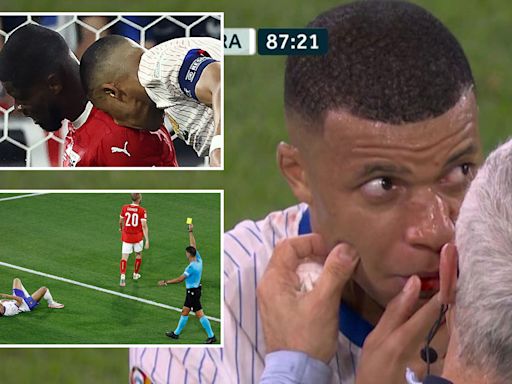 Kylian Mbappe appears to break nose before being handed yellow card