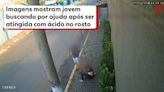 Jovem atacada com soda cáustica continua na UTI, mas está consciente e consegue falar