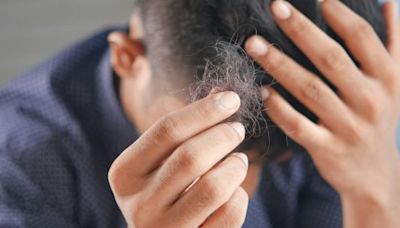 Estos son los peligros que te exponés por no lavarte el pelo en varios días, según una dermatóloga