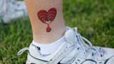 Tattoos may be risk factor for malignant lymphoma, study finds