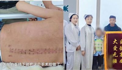 援藏醫生跨越3000公里接9歲男童手術 成功矯正脊柱身高增高3厘米