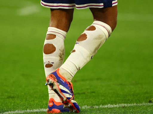 Why do Jude Bellingham and other footballers cut holes in their socks?