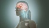Post-Stroke Recovery: Can Stimulation Of The Vagus Nerve Help?