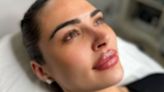 Forgotten Love Island star shows off dramatic new lips after cosmetic treatment