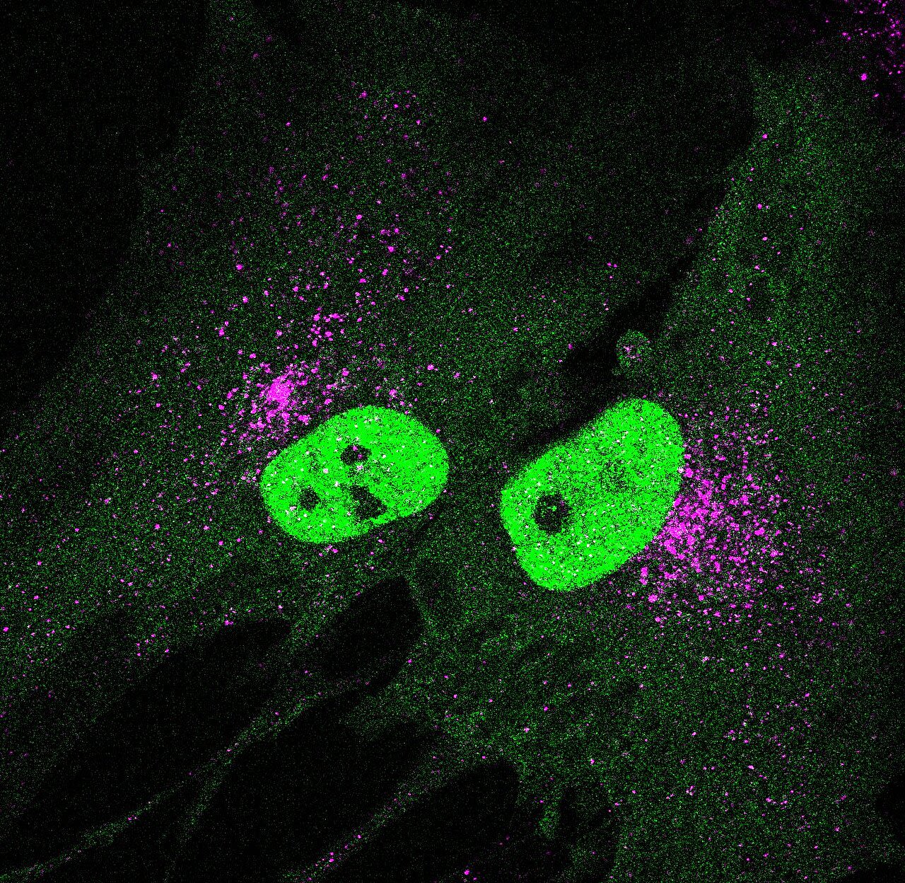 Double-edged STING: A new pathway involved in aging