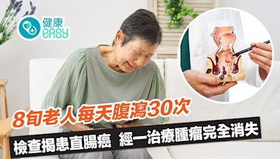 癌症｜8旬老人每天腹瀉30次終確診直腸癌！經這治療腫瘤完全消失