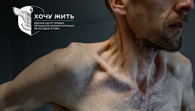 Photos of released Ukrainian prisoners of war show emaciated bodies in ‘horrifying’ condition | CNN