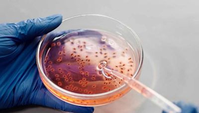 Brazil records world's first Oropouche virus deaths