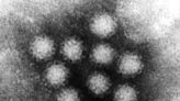 Norovirus outbreak: Contagious stomach flu has made its way to New Jersey