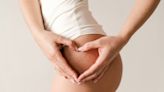 Can you reverse stretch marks? What works according to an NHS doctor