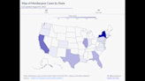 Monkeypox cases by state: Track the virus in NC and across US with interactive map