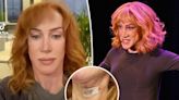 Kathy Griffin shares pic of neck bandaged up after 2nd vocal cord surgery