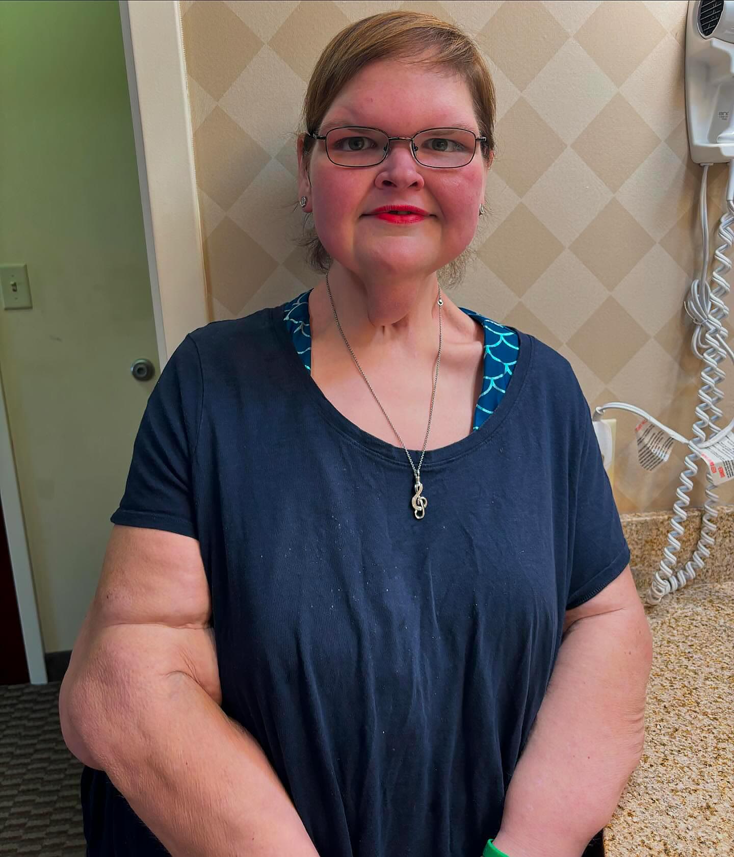 ‘1000-Lb. Sisters’ Star Tammy Slaton Wants ‘Head-to-Toe’ Skin Removal Surgery