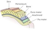 Viral meningitis