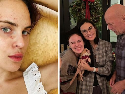 Demi Moore’s Daughter Tallulah Wills Drops Photos Of Her Health Disorder: 'Want So Badly To Share How I Achieved...