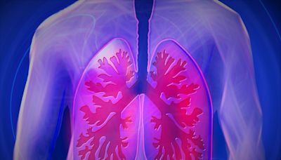 Second Phase 3 clinical trial again shows dupilumab lessens disease in COPD patients with type 2 inflammation