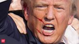 Donald Trump assassination attempt: Where are the stitches? Where are the scars?" Know in detail.
