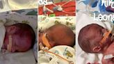 Colorado Cops Help Deliver Triplets After Responding to Call About a Screaming Woman