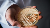 Warning as fungus ‘superbug’ cases at highest levels in Nevada