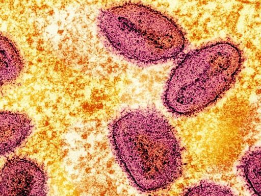 India reports first mpox case of clade 1b from Kerala’s Malappuram district