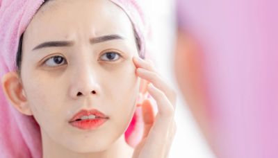 Tomatoes can actually help reduce dark under-eye circles, says skincare pro