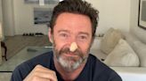 Hugh Jackman: la imagen con la que el actor alerta sobre el cáncer de piel