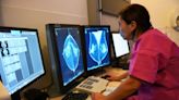 Task force now recommends breast cancer screenings start at age 40