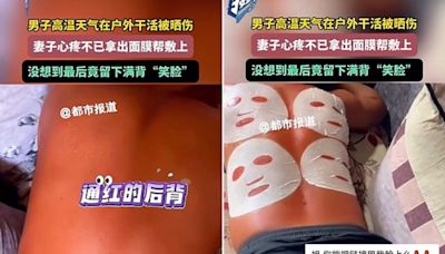 烈日工作背曬傷陸妻幫敷「面膜」 效果不錯但….笑爆了！ - 社會