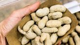 A woman whose vagina burned after sex was told her partner's semen contained traces of peanuts, which was making her allergy flare up