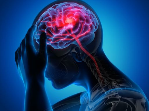 What is a stroke and how to spot the symptoms