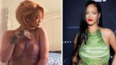 Rihanna Shows Post-Baby Body After Plastic Surgery Confession