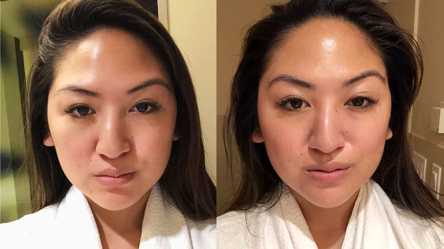 I Let a Facialist Electrocute My Face for Better Cheekbones and It Actually Worked