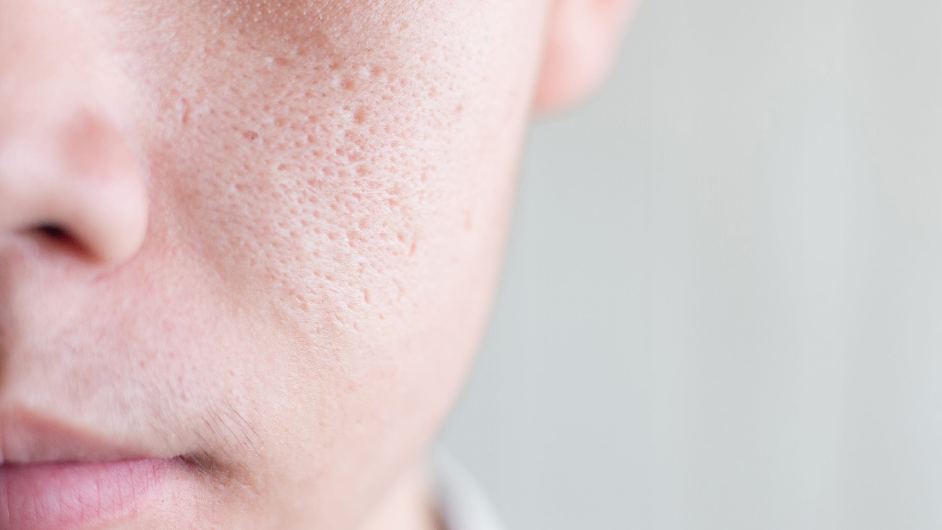 Feel like you have huge pores? Here's what experts say you can do about it.