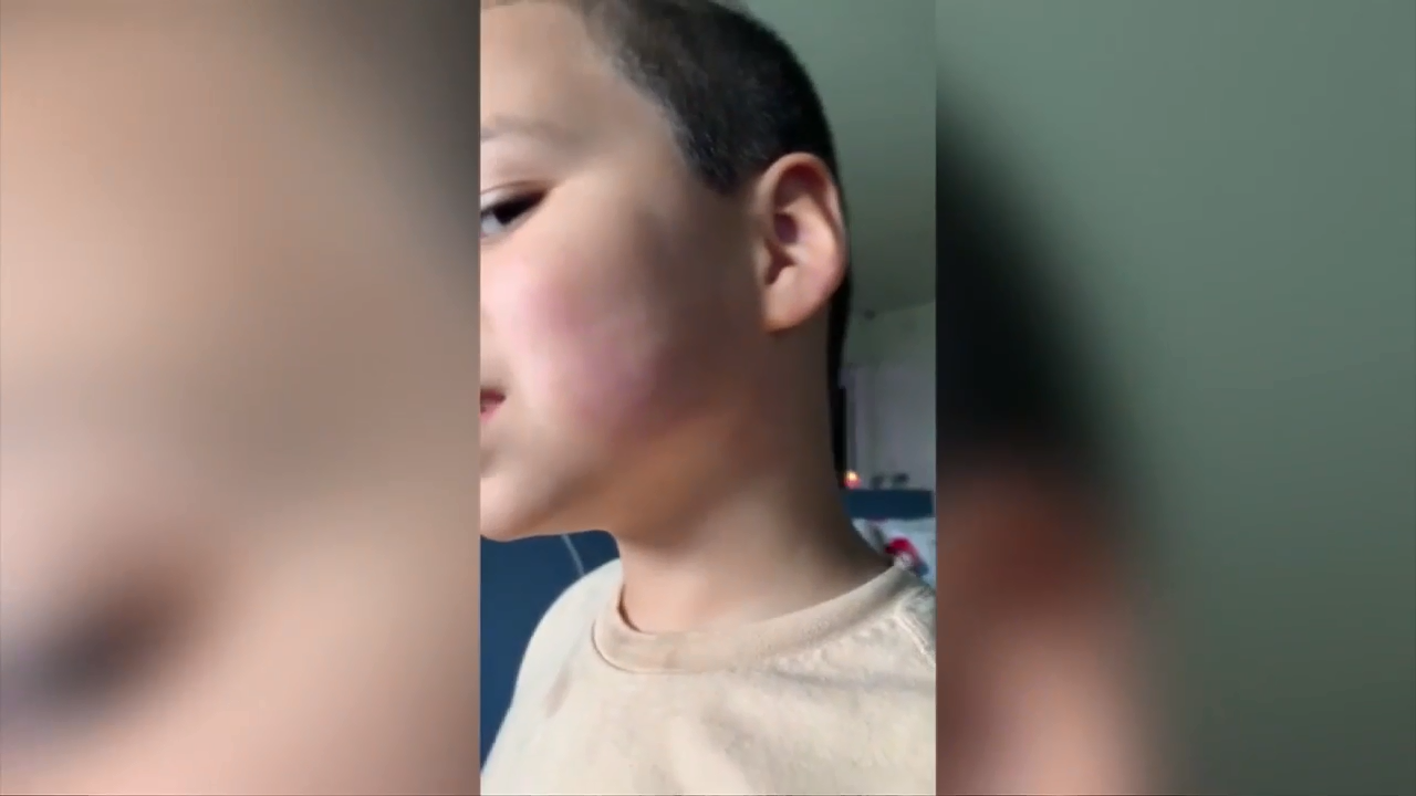 Cutler Bay mother demands answers after she says her son was slapped by his music teacher - WSVN 7News | Miami News, Weather, Sports | Fort Lauderdale