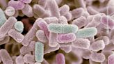 Drug-resistant infections more likely to strike women, says WHO