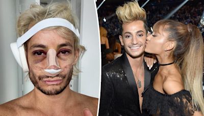 Ariana Grande reacts to brother Frankie’s bruised and bloodied selfie after nose job