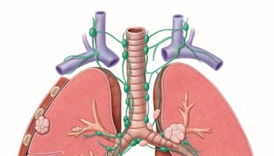 ASCO24: Akeso’s bispecific vvonescimab faces a rocky road ahead in NSCLC
