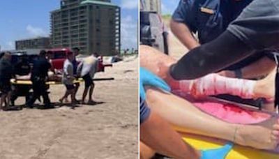 Cuatro heridos por ataques de tiburón en una isla de Texas