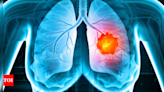 How common is lung cancer in non-smokers? - Times of India