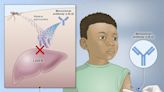 Experimental NIH Antibody Protects Children From Malaria in Clinical Trial