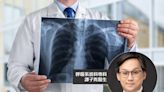 間質性肺病可致肺纖維化 呼吸系統科專科醫生解說成因、治療及預防方法