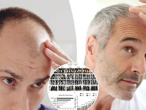 A breakthrough for baldness? Sugar gel stimulates hair regrowth